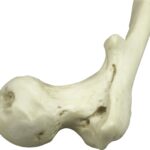 Replica Human Left Femur with Polio