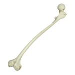Replica Human Left Femur with Polio