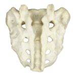 Replica Human Sacrum with Spina Bifida