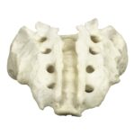 Replica Human Sacrum with Spina Bifida
