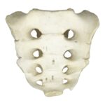 Replica Human Sacrum with Spina Bifida