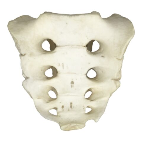 Replica Human Sacrum with Spina Bifida