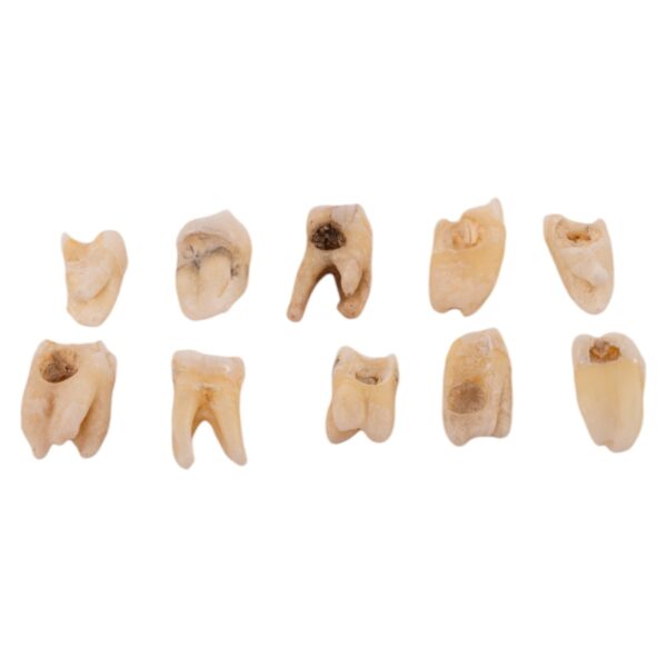 Real Human Molar