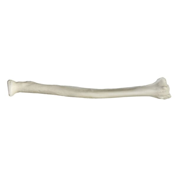 Replica Human Radius