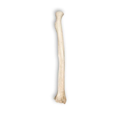 Real Human Radius