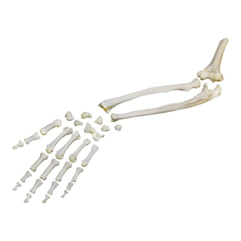 Real Research Quality Human Hand with Radius and Ulna - Disarticulated