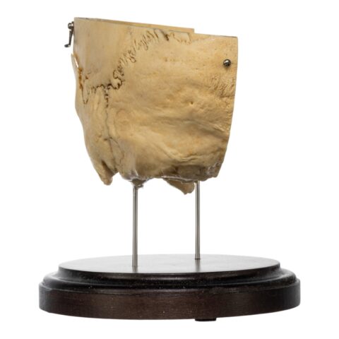 Real Human Partial Skull on Stand - 264 g
