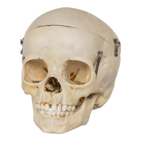 Real Human Child Skull - 254 g