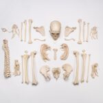 Real Research Quality Human Skeleton – Disarticulated (Pathology)