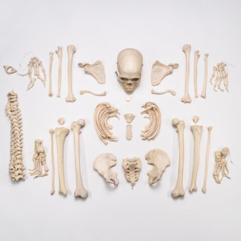 Real Research Quality Human Skeleton - Disarticulated (Pathology)