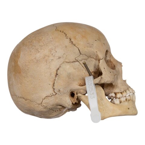 Real Human Child Skull - 400 g