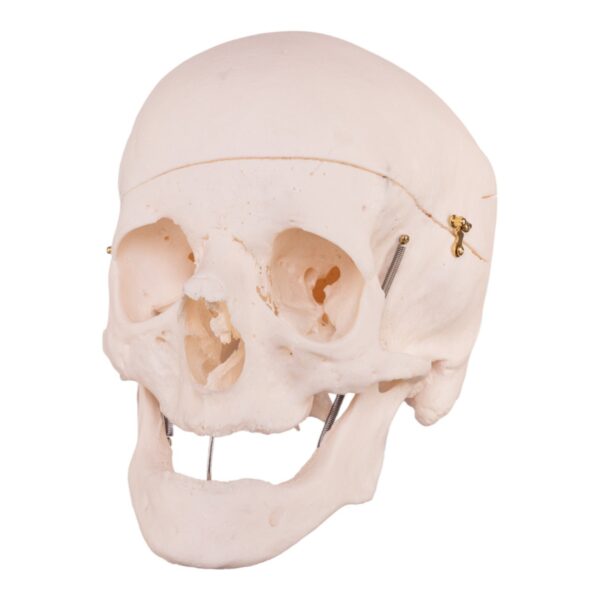 Real Research Quality Human Skull – 16.7199 oz