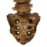 Real Human Spine and Sacrum – Antique