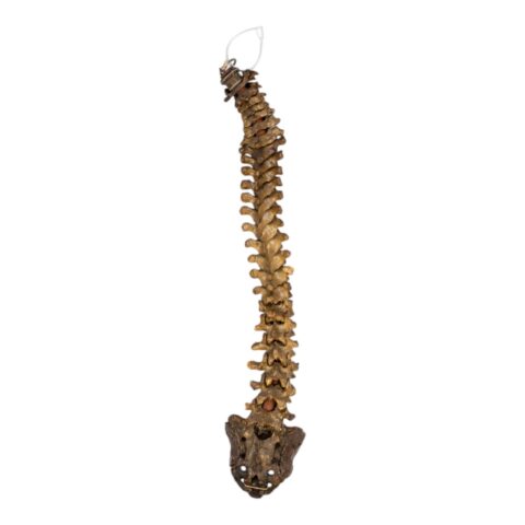 Real Human Spine and Sacrum - Antique
