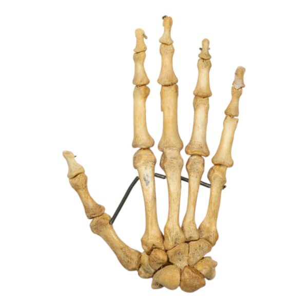 Real Human Hand – Antique
