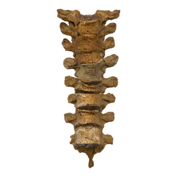 Real Human Thoracic Vertebrae – Set of 8