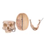 Real Human Dissected Skull with Carrying Case