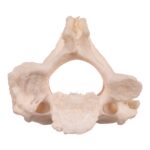 Real Research Quality Human Cervical and Axis Vertebrae – Fused