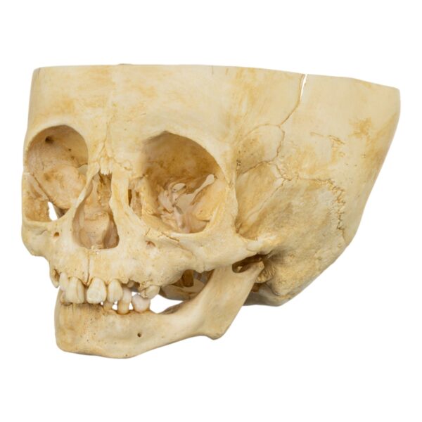 Real Human Child Skull – Partial