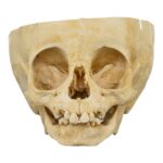 Real Human Child Skull – Partial