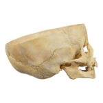 Real Human Child Skull – Partial