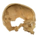 Real Human Skull – Partial – 230 g