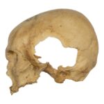 Real Human Skull – Partial – 230 g