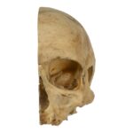 Real Human Skull – Partial – 230 g
