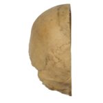 Real Human Skull – Partial – 230 g