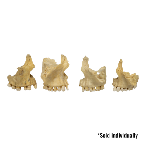 Real Human Maxillary Bone - Antique (Single)