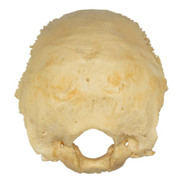 Real Human Occipital Bone – Damaged