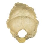 Real Human Occipital Bone – Damaged