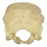 Real Human Occipital Bone – Damaged