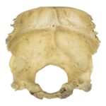 Real Human Occipital Bone – Damaged