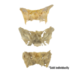 Real Human Sphenoid Bone – Damaged (Single)