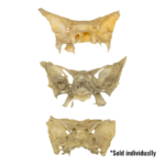 Real Human Sphenoid Bone – Damaged (Single)