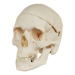 Real Research Quality Human Skull – Pathology