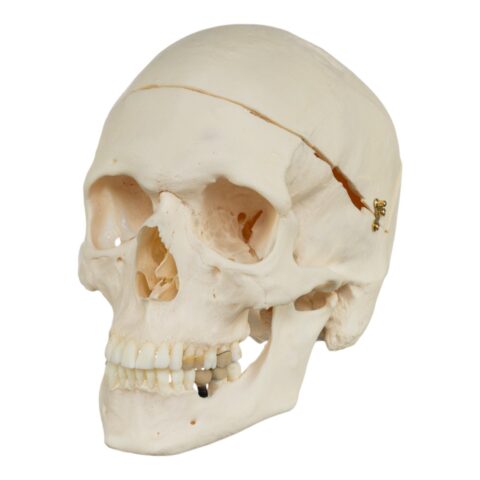 Real Research Quality Human Skull - Pathology