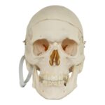 Real Research Quality Human Skull – Pathology