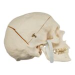 Real Research Quality Human Skull – Pathology