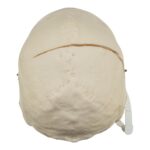 Real Research Quality Human Skull – Pathology