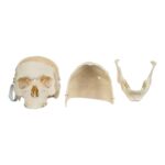 Real Research Quality Human Skull – Pathology