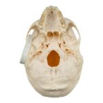Real Research Quality Human Skull – Pathology