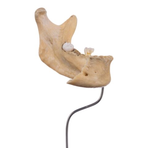 Real Human Partial Mandible On Stand