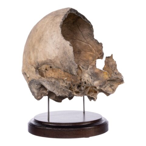 Real Human Partial Skull on Stand - 368 g