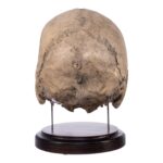 Real Human Partial Skull on Stand – 368 g