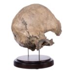 Real Human Partial Skull on Stand – 368 g