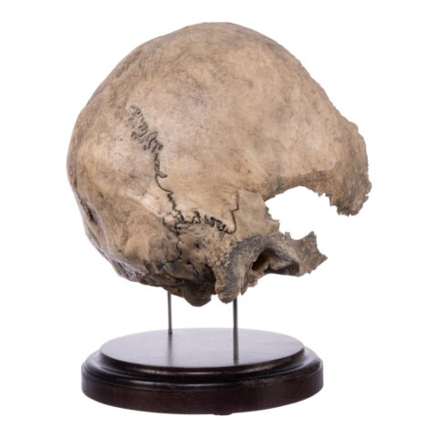 Real Human Partial Skull on Stand - 368 g