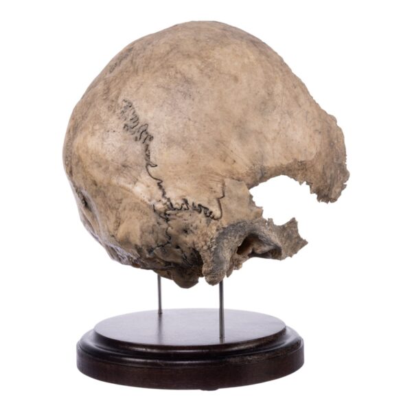 Real Human Partial Skull on Stand – 368 g