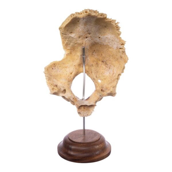 Real Human Partial Skull on Stand – 96 g